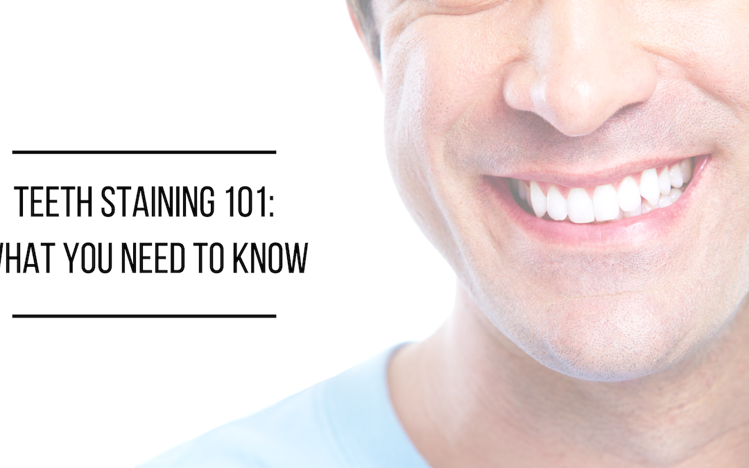 Teeth Staining 101: What You Need to Know