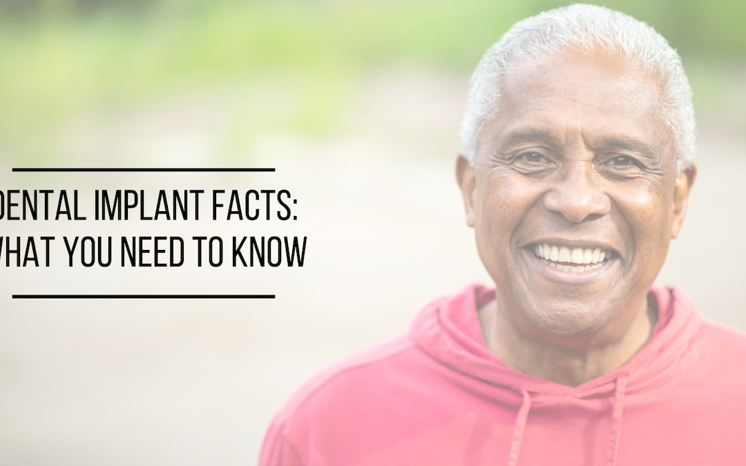 Dental Implant Facts: What You Need To Know