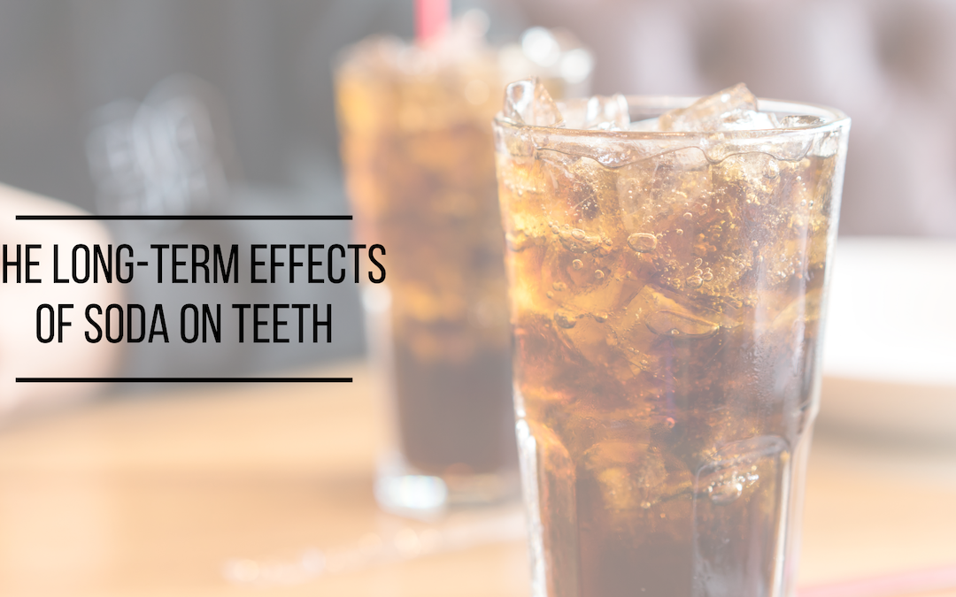 The Long-Term Effects of Soda on Teeth