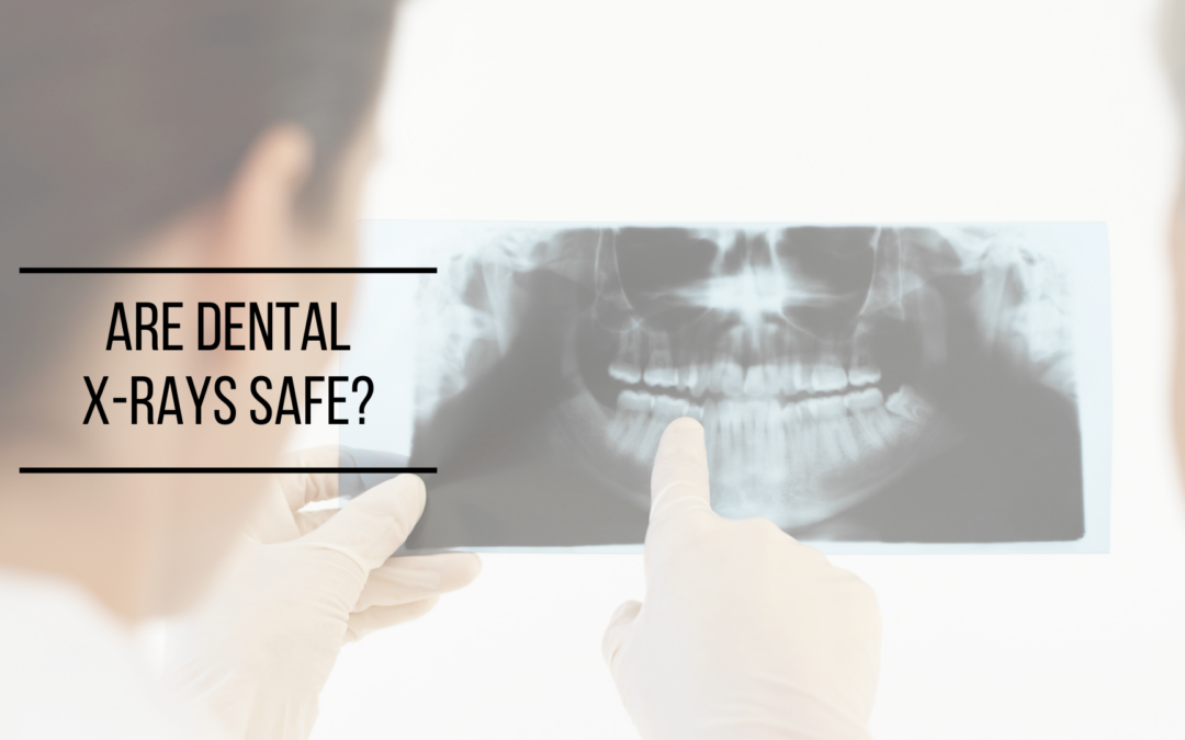 Are Dental X-Rays Safe?