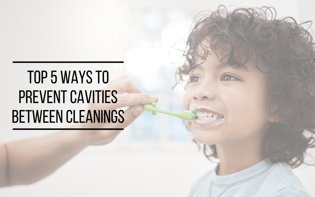 Top 5 Ways to Prevent Cavities Between Cleanings